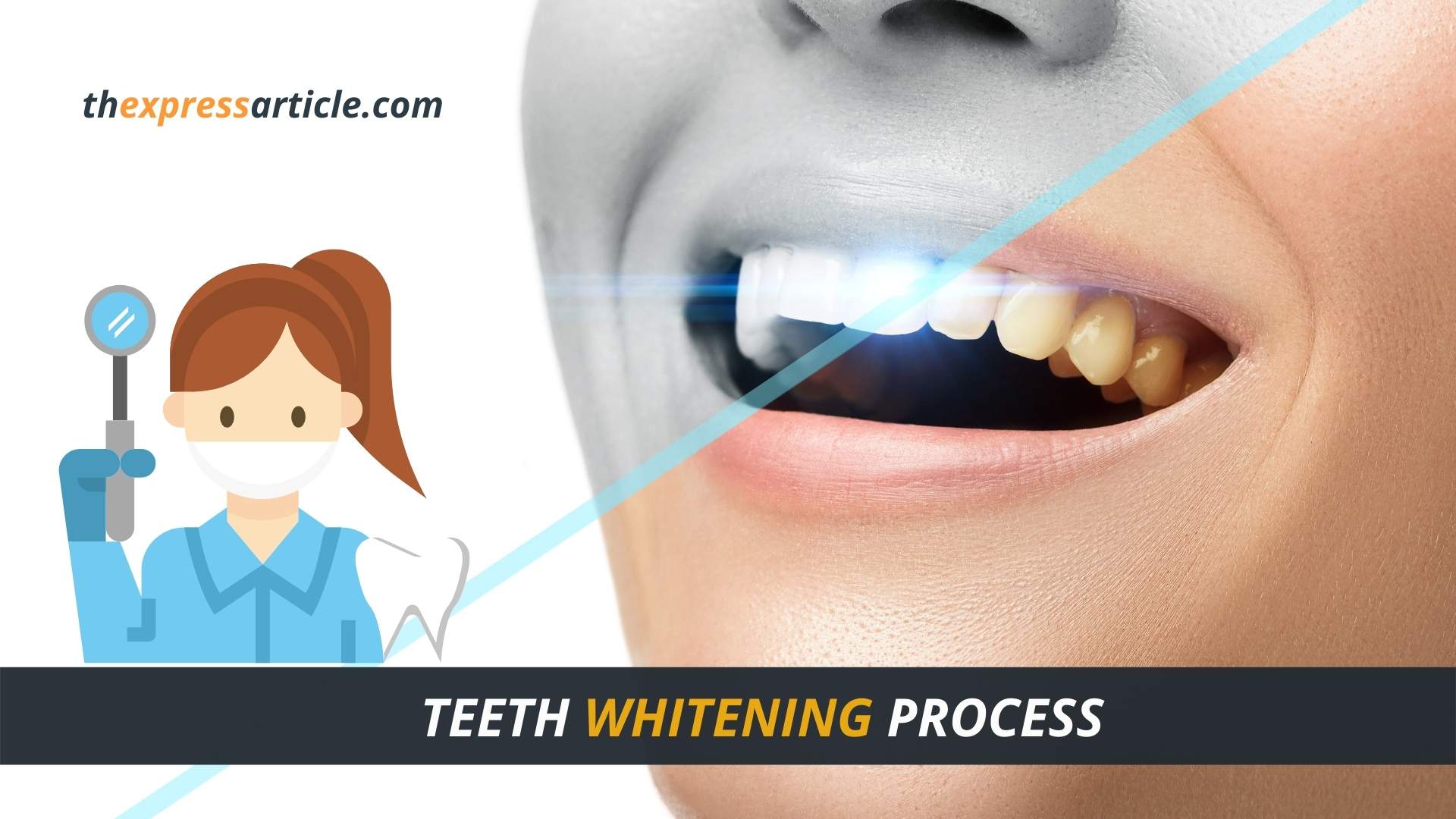 What is Teeth Whitening Process