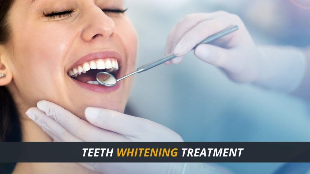 Teeth Whitening Process and its cost